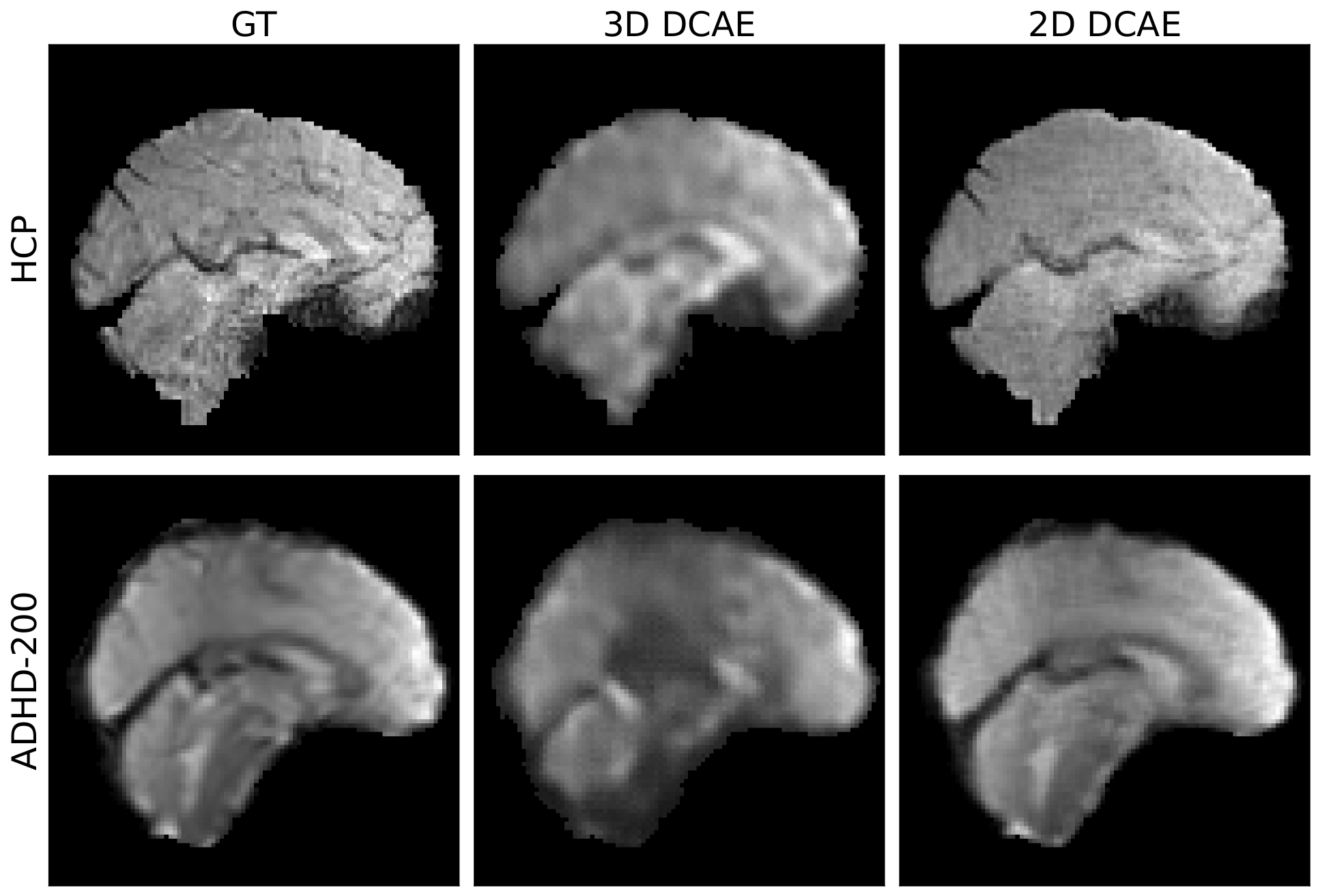 Reconstruction comparison between 3D DCAE and 2D DCAE